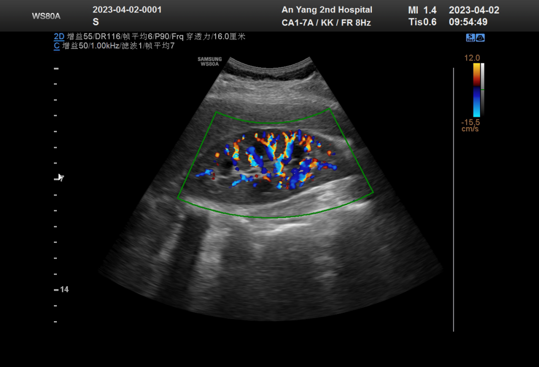 1681872388252261.png 640 (1).png