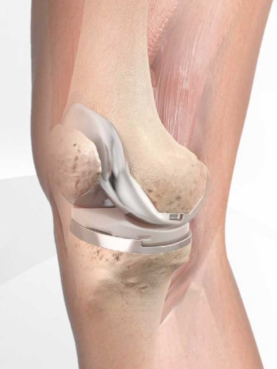 1700789699174043.jpg 1700789699174043.jpg